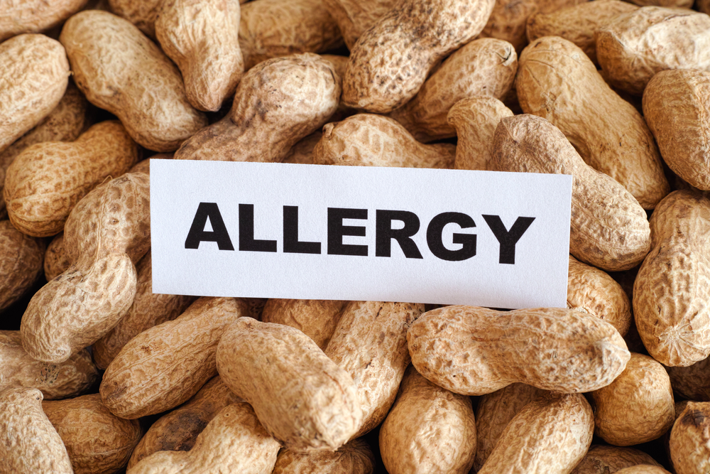 Pile of peanuts with a sign that says "allergy" laying on top of the pile